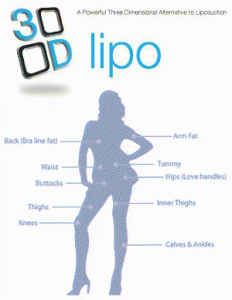 3D Lipo inch loss treatments